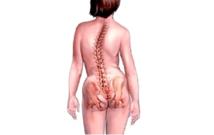 redenen voor de ontwikkeling van cervicale osteochondrose