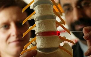 Symptomen en behandeling van osteochondrose van de thoracale wervelkolom