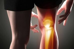 vernietiging van het kniegewricht als gevolg van artrose